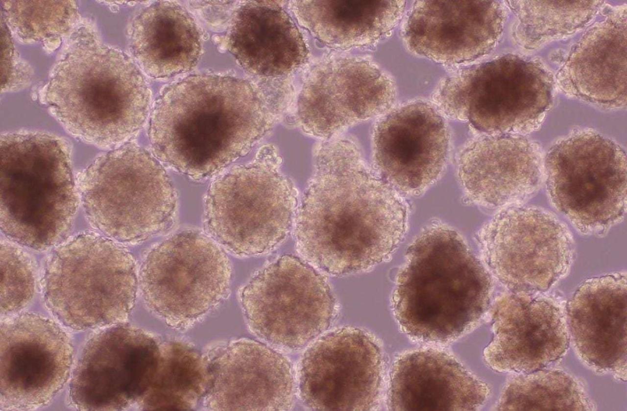 ヒトiPS細胞から作製した心筋球移植による心臓再生に成功 －移植後の不整脈を抑えた細胞移植治療が可能に－ その1